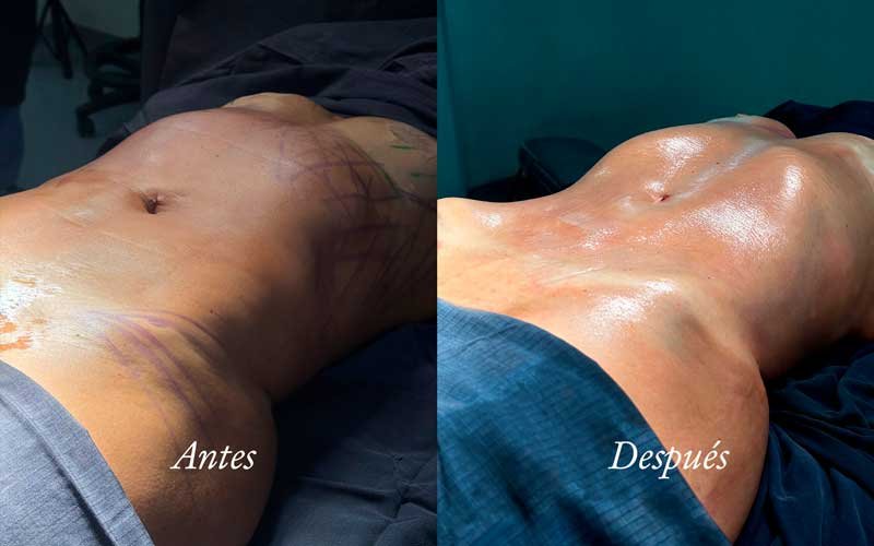 Resultado antes y después — Dr. Alejandro Orozco