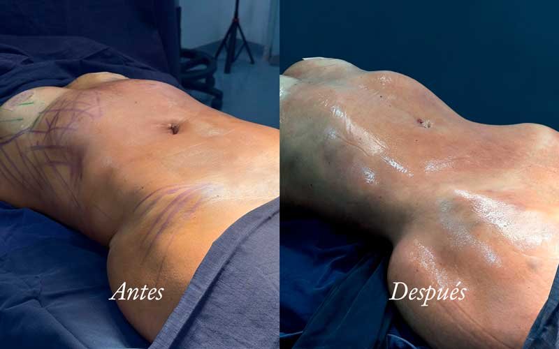 Resultado antes y después — Dr. Alejandro Orozco